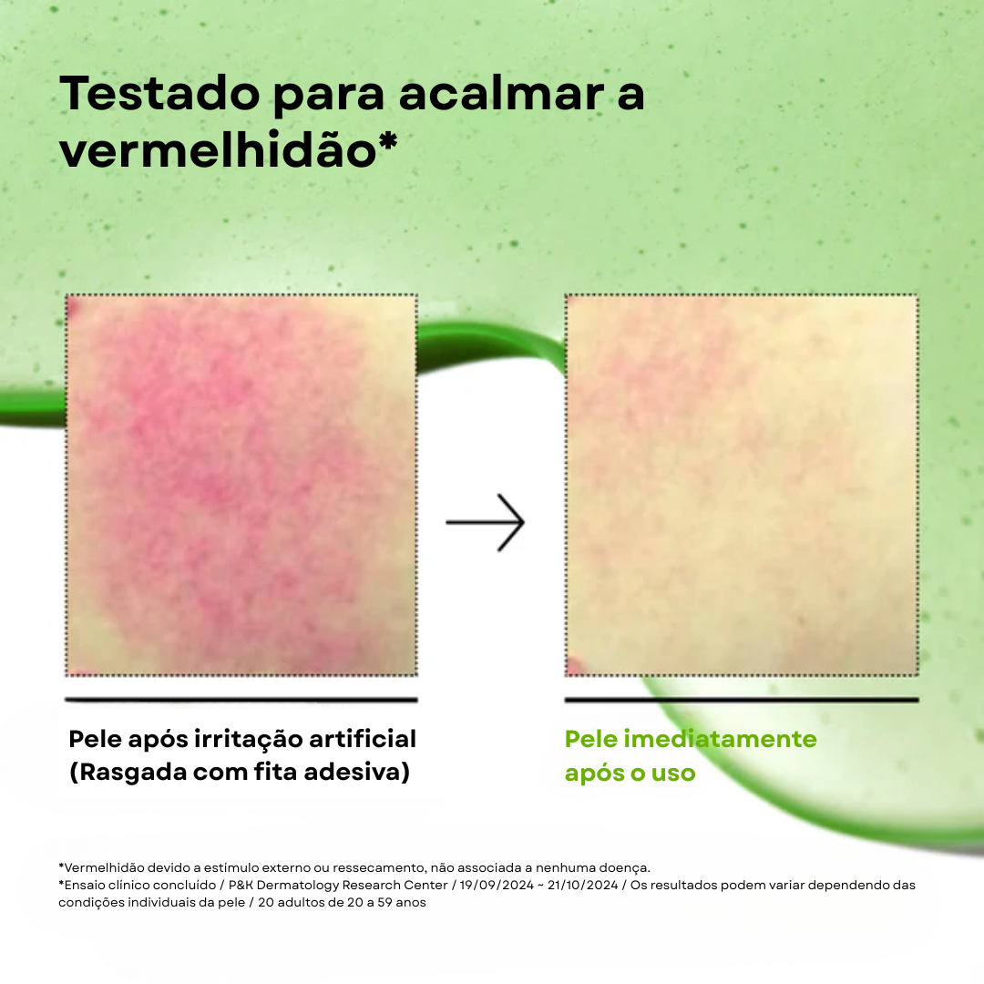 Sérum Ácido Azelaico 10% para Vermelhidão e Acne | Anua