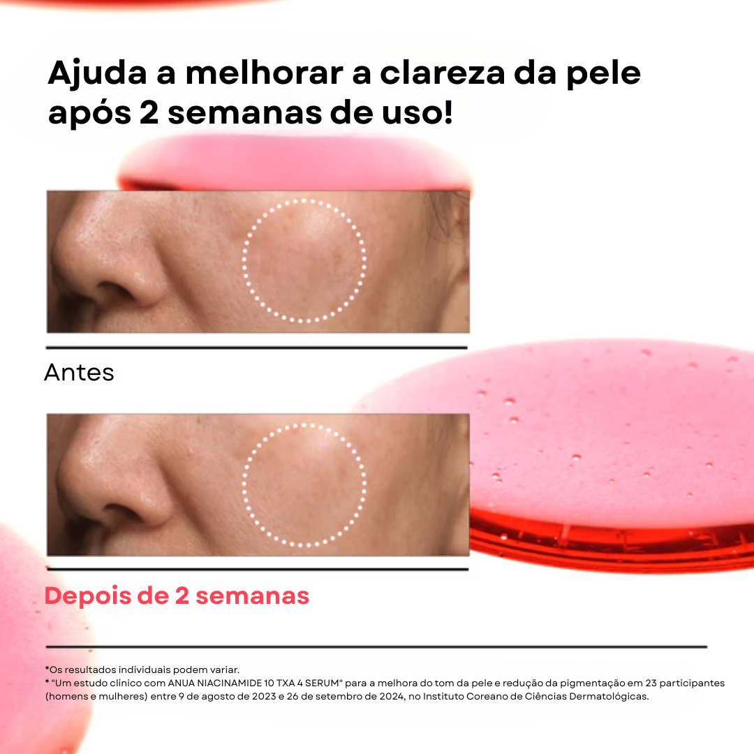 Sérum Niacinamida 10% + TXA 4% para Manchas | Anua