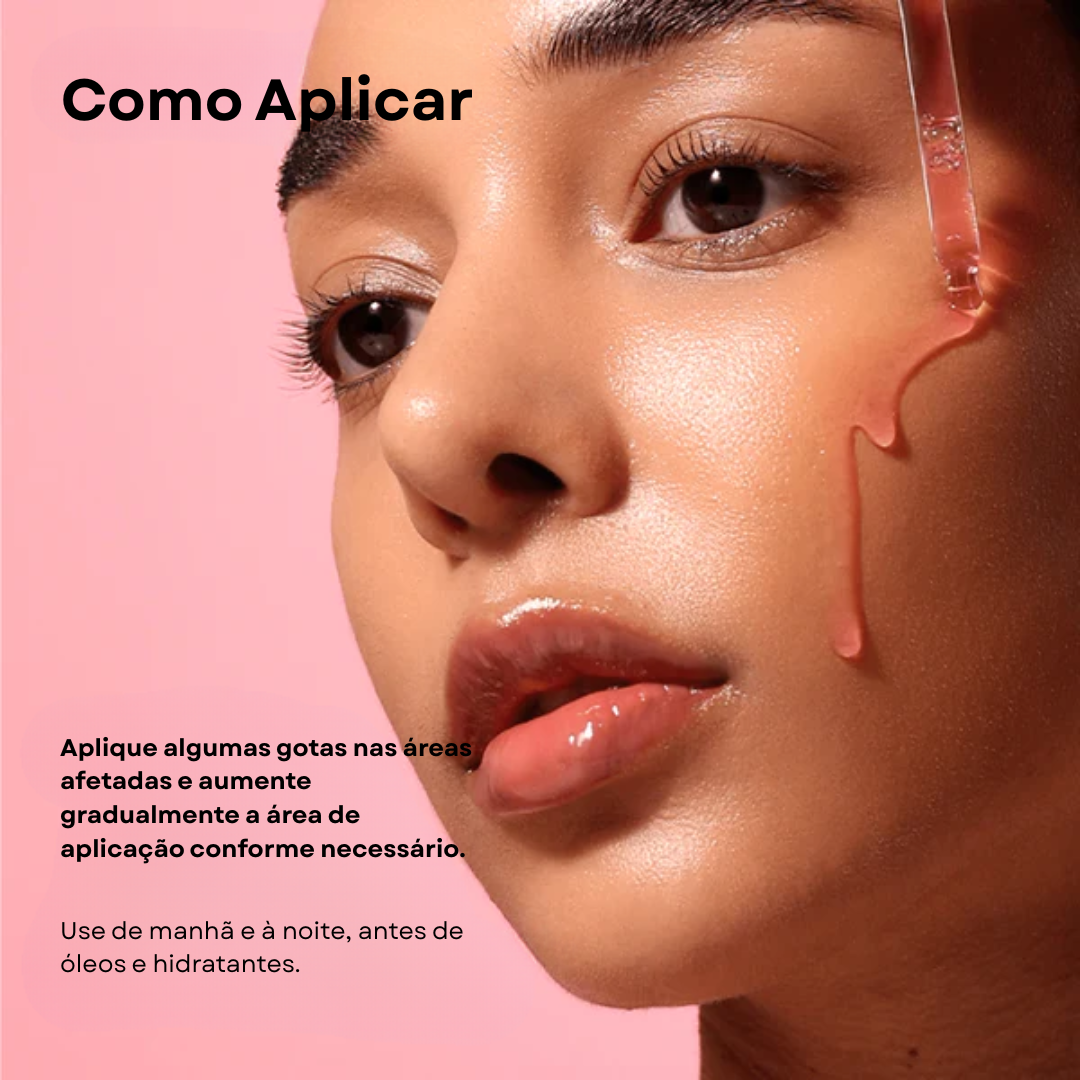 Sérum Niacinamida 10% + TXA 4% para Manchas | Anua