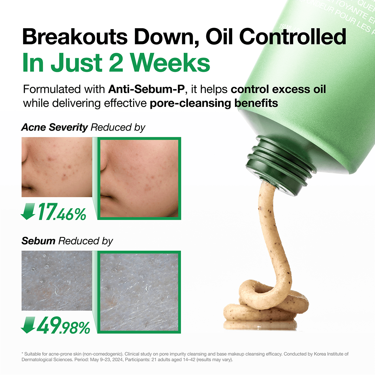 Anua Double Cleansing Duo Set leaving the skin feeling thoroughly purified, calm, and refreshed.