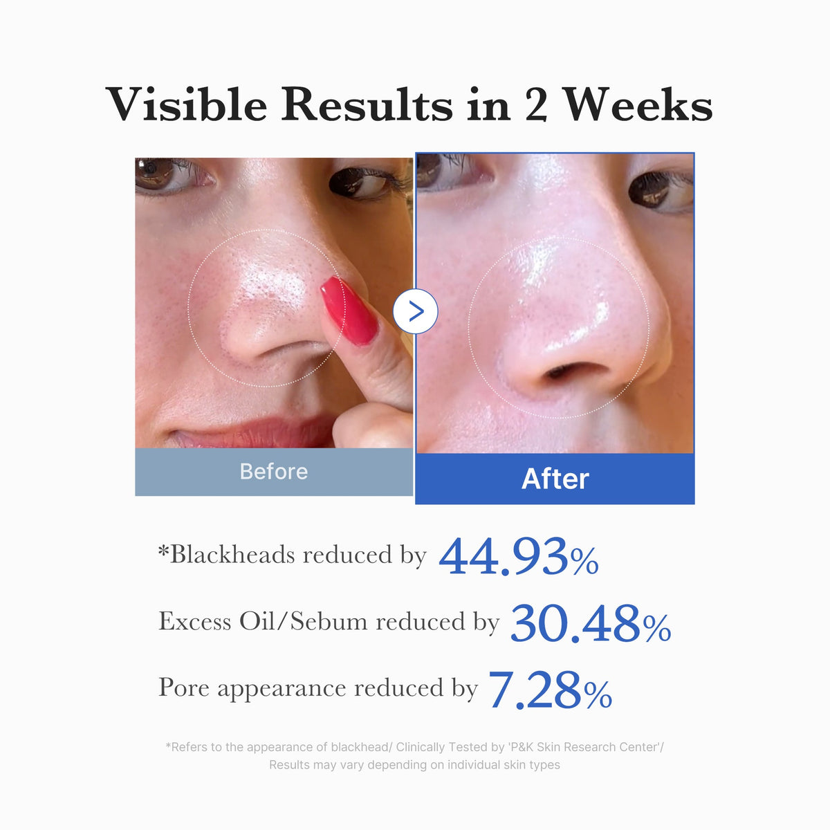 Your smoothest skin texture yet. The ultimate K-Beauty staple to minimize the appearance of enlarged pores and sweep away dead skin cells without irritation.