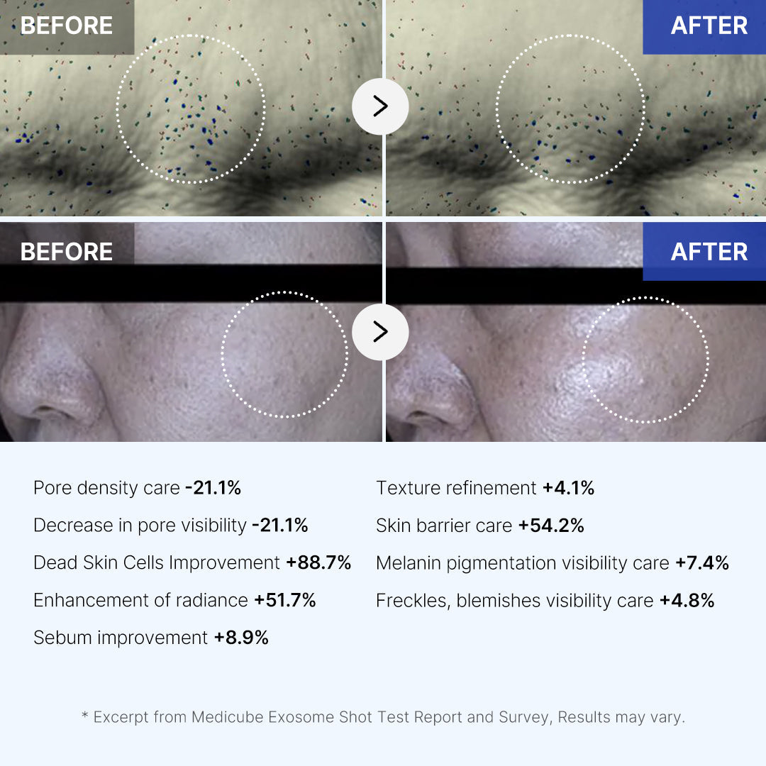 Medicube Exosome Shot 7500 Serum promoting a more even and radiant complexion overnight.