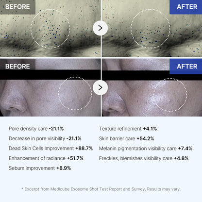 Medicube Exosome Shot 7500 Serum promoting a more even and radiant complexion overnight.