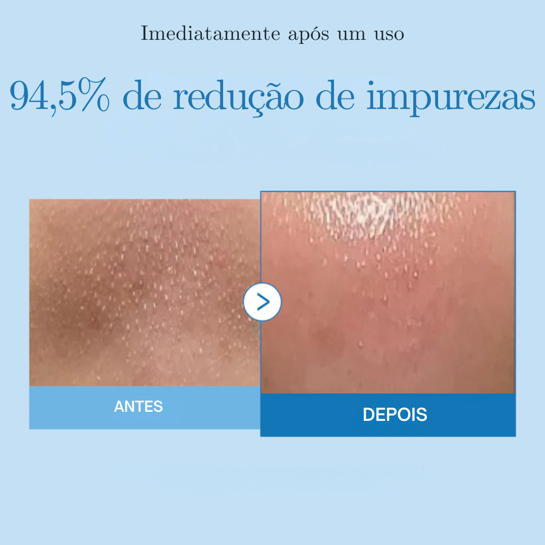 Óleo de Limpeza Zero Pore com LHA e Niacinamida | Medicube