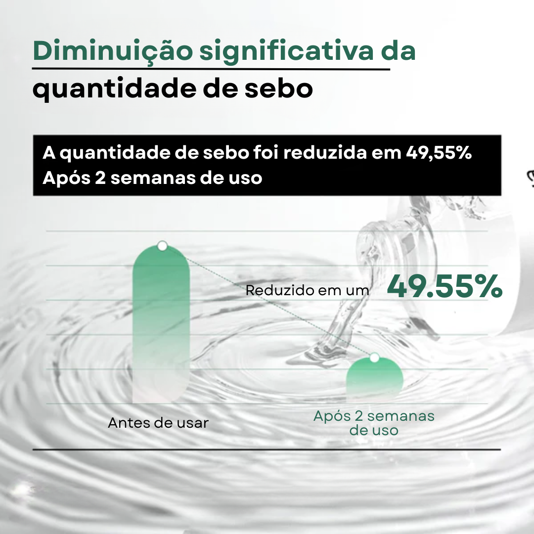 Tônico Calmante Heartleaf 77% para Peles Sensíveis | Anua