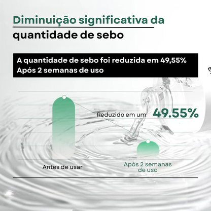 Tônico Calmante Heartleaf 77% para Peles Sensíveis | Anua