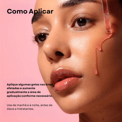 Sérum Niacinamida 10% + TXA 4% para Manchas | Anua