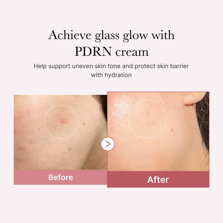 Medicube PDRN Pink Peptide Face Cream evening out skin tone and reducing dullness with niacinamide.