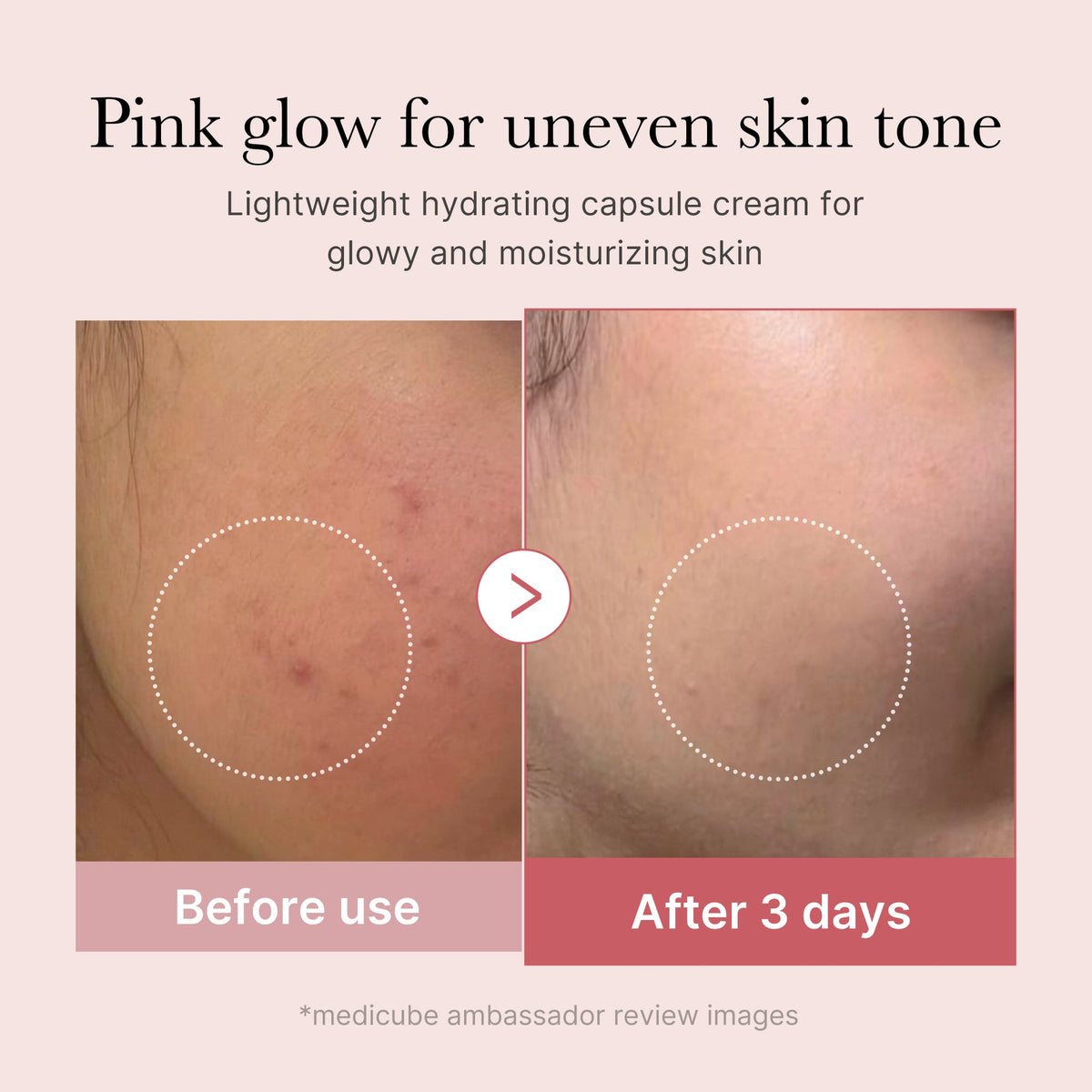 Medicube PDRN Pink Collagen Capsule Cream improving skin elasticity and firmness.
