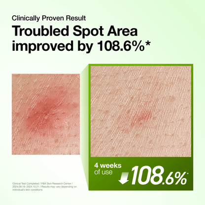 Anua Azelaic Acid 10% + Hyaluron Serum calming skin inflammation and reducing blackheads with cica and blue tansy oil.