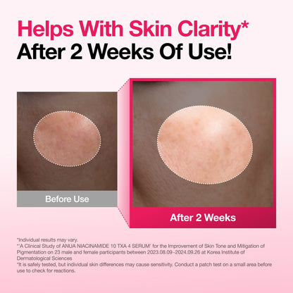 Anua Niacinamide 10% + TXA 4% Serum fading hyperpigmentation and promoting an even, luminous skin tone.